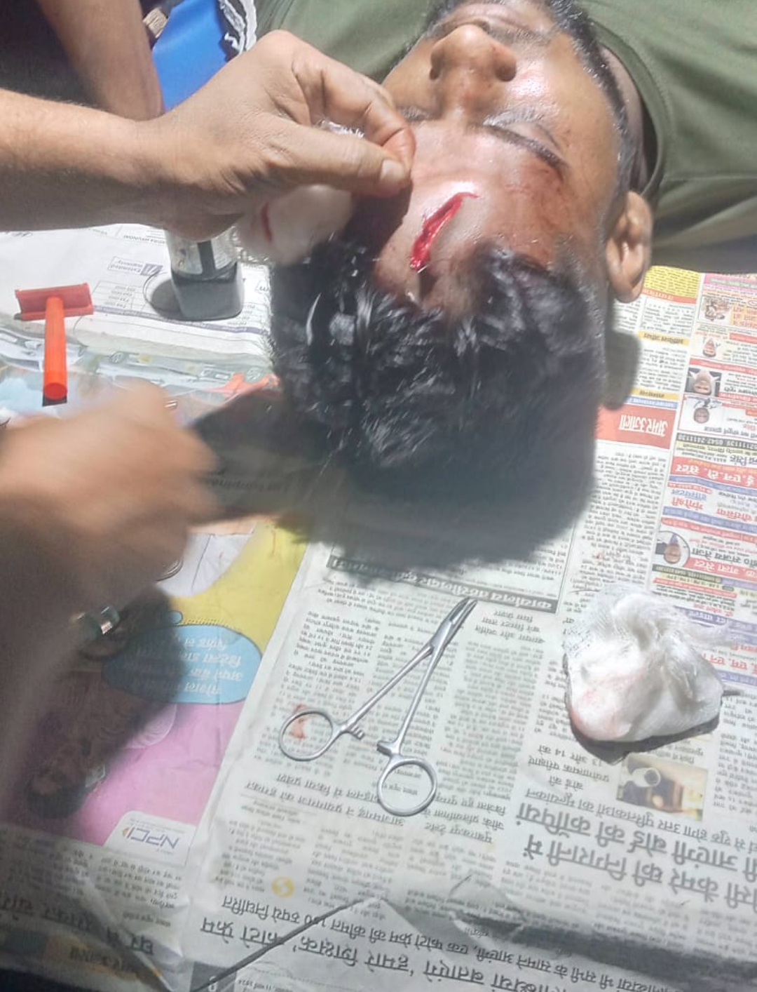 आए दिन पत्थर बाजी से रेल यात्री हो रहे हैं चोटिल